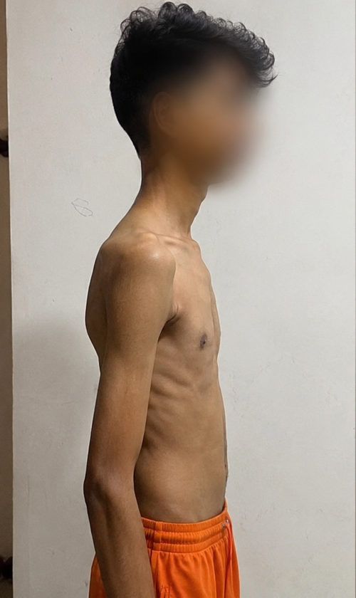 Before transformation photo