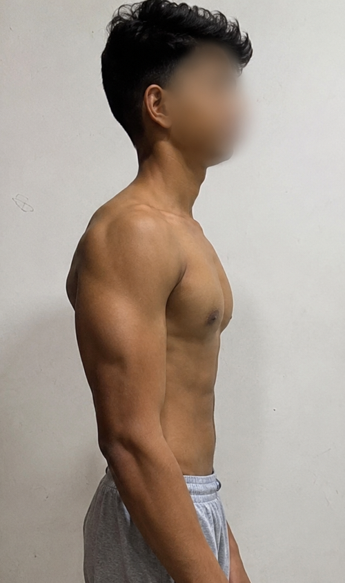 After transformation photo